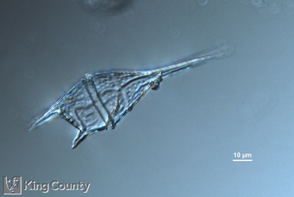 Photo of Ceratium lineatum